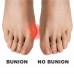 My Feet Gel Bunion Guard with Toe Spacer One Size (PAIR)